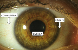 Anatomia della cornea - Figura 1